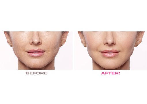 جهاز تقشير وإزالة شعر الوجه-Flawless Dermaplane Glo جهاز تقشير وإزالة شعر الوجه-Flawless Dermaplane Glo أجهزة إزالة شعر الجسم جهاز تقشير وإزالة شعر الوجه-Flawless Dermaplane Glo جهاز تقشير وإزالة شعر الوجه-Flawless Dermaplane Glo أجهزة إزالة شعر الجسم